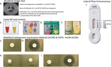 Phenotypic Methods for the Detection of Carbapenemases