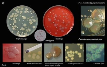  Pseudomonas aeruginosa: Properties, Virulence Factors, Lab Diagnosis, and Antibiotic Resistance