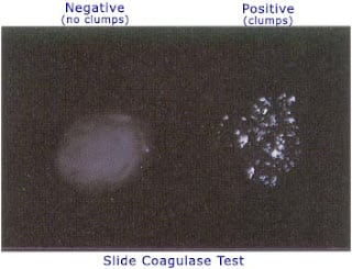 Coagulase Test: Principle, Procedure, Results