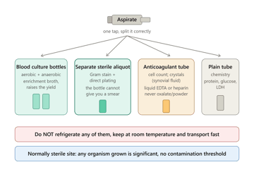 Sterile Body Fluids: Collection and Transport (Pleural, Peritoneal, Pericardial, Synovial)