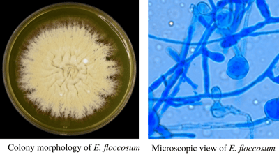 Epidermophyton floccosum: Identification and Microscopic Appearance
