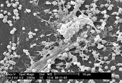 Staphylococcus epidermidis: Biofilm, Device Infections, and Lab Diagnosis