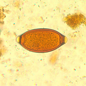 Trichuris trichiura (Whipworm): Life Cycle, Pathogenesis, Treatment, and Laboratory Diagnosis