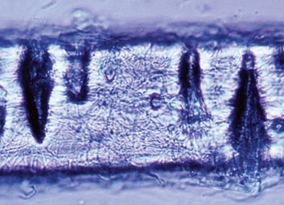 Hair Perforation Test: Principle, Procedure, and Interpretation