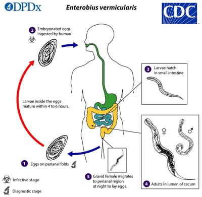 Enterobius vermicularis (Pinworm): Life Cycle, Pathogenesis, Treatment, and Laboratory Diagnosis