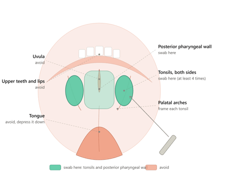 Throat Swab: Collection, Transport, and Lab Diagnosis