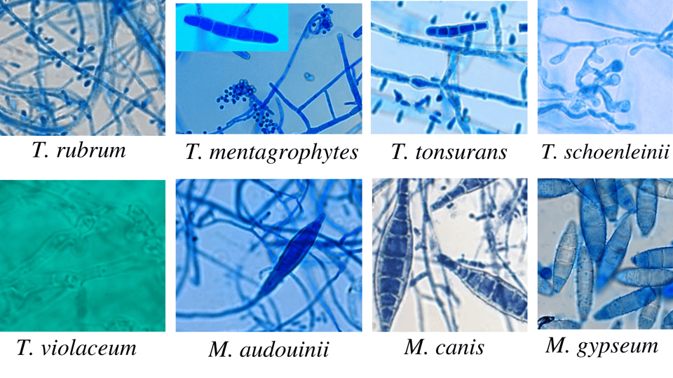 Trichophyton: Species, Identification, and Microscopic Appearance