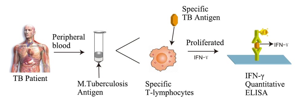 Interferon-Gamma Release Assay (IGRA): Principle, Procedure, and Interpretation