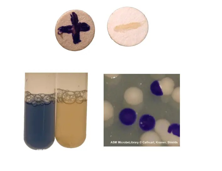 Various types of Oxidase test