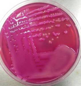 Mixed growth of mucoid Lactose fermenting colonies and NLF colonies in MacConkey Agar