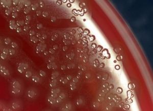 Draughtmans colonies of S. pneumoniae