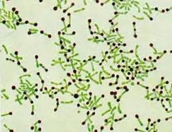corynebacterium diphtheriae simple stain