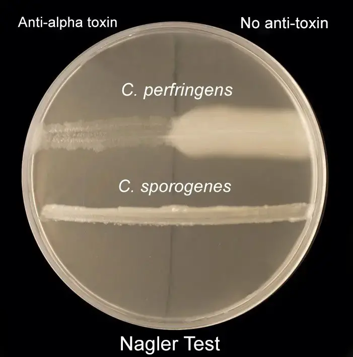 Nagler Reaction or Lecithinase Test