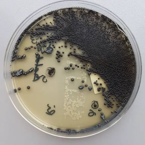 Corynebacterium glucuronolyticum. Коринобактерия дифтерия. Corynebacterium diphtheriae бактерия. Коринебактерии дифтерии. Коринебактерия дифтерии под микроскопом.