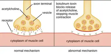 Clostridium botulinum: Properties, Pathogenesis, Lab Diagnosis • Microbe  Online
