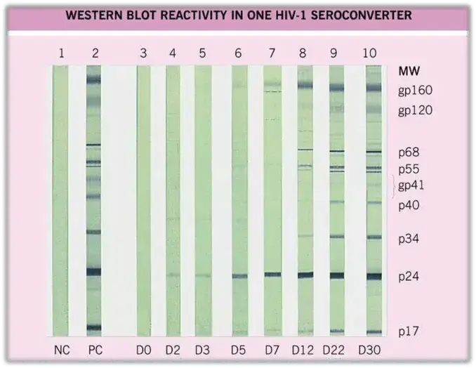 Western Blot Test for HIV diagnosis 