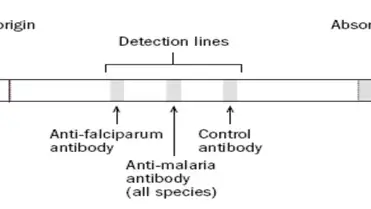 Rdts For Malaria Diagnosis Principle Results And Advantages Learn Microbiology Online