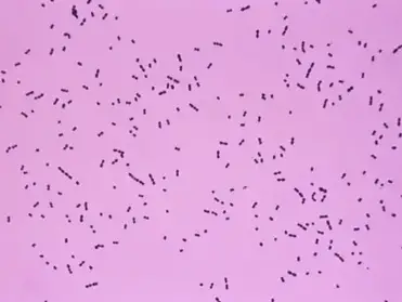 How To Identify Streptococcus Pneumoniae Microbe Online