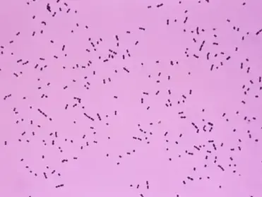 How To Identify Streptococcus Pneumoniae Microbe Online How To Identify Streptococcus Pneumoniae Microbe Online