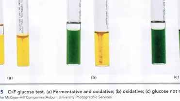 Oxidative Fermentative Of Test Principle Procedure And Results Learn Microbiology Online
