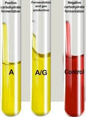 Carbohydrate Fermentation Test Uses Principle Procedure And Results Learn Microbiology Online