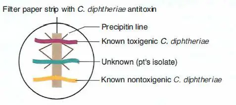 Elek test Principle, Procedure, Result 1 Elek Test