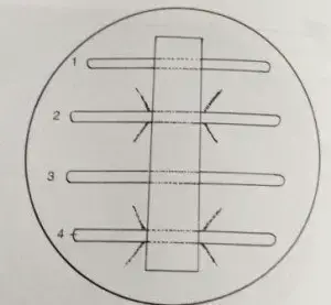 Elek test for demonstration of toxin production by C. diphtheriae
