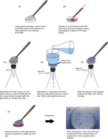 Bacteriological Analysis Of Water Using Membrane Filtration Technique Learn Microbiology Online