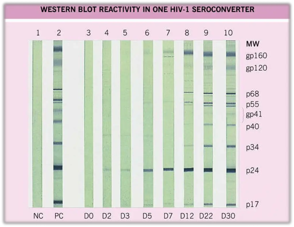Western Blot for HIV diagnosis