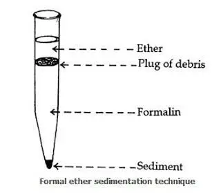 Formal Ether Sedimentation Technique