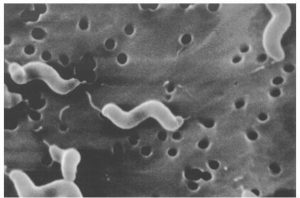 Campylobacter: Amphitrichous (bipolar) flagella