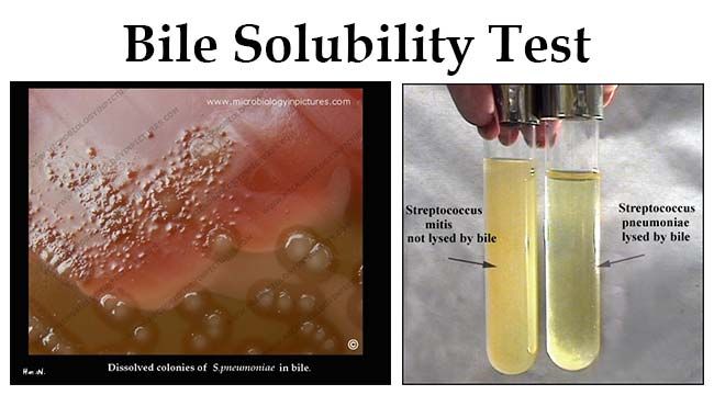 bile-solubility-test-principle-procedure-results-microbe-online