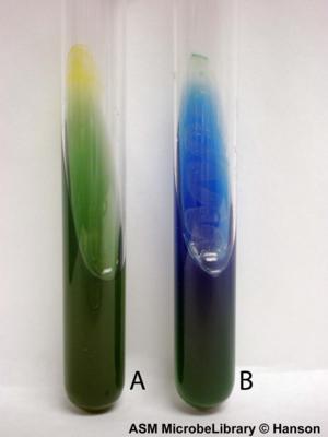 urea hydrolysis test