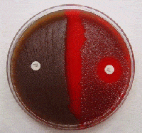 test results procedure streptococcus pneumoniae sensitivity principle expected control positive gram tests bacteria susceptible biochemical microbeonline organism side right