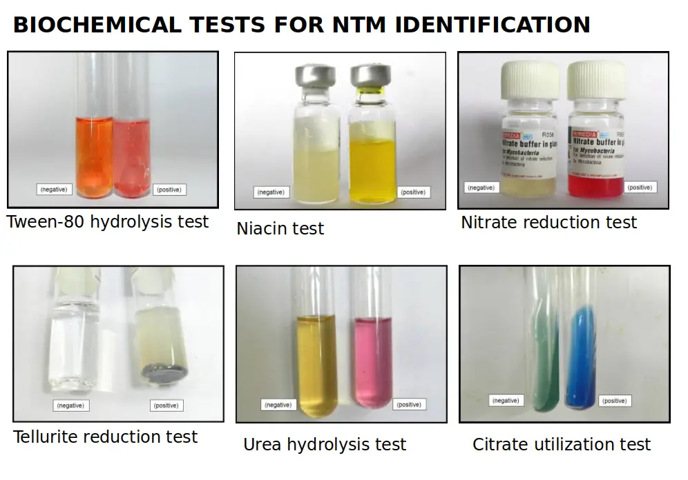 Biochemical test for Mycobacteria and NTM