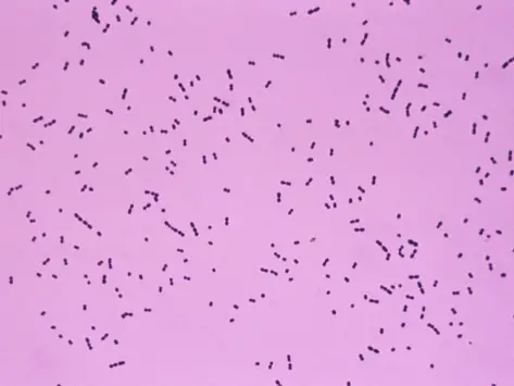 gram positive cocci streptococcus