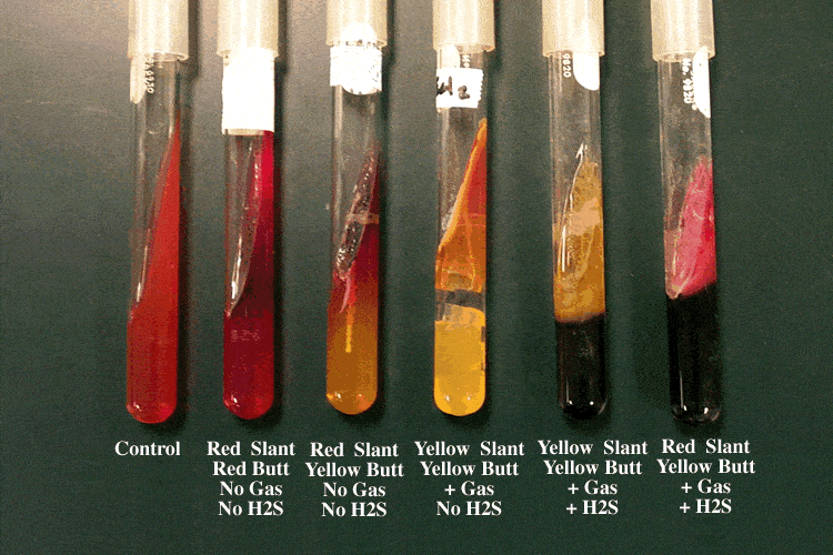 Triple Sugar Iron (TSI) Agar: Principle, Results, and Interpretation