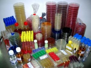 Different types of Bacteriological culture media used in Microbiology lab