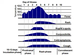 Fig: Clinical features of typical measles - time course from onset of illness