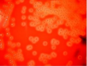 Beta Hemolysis in Sheep Blood Agar.