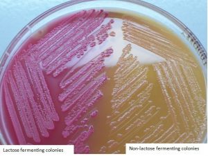 LF and NLF colonies in MacConkey Agar