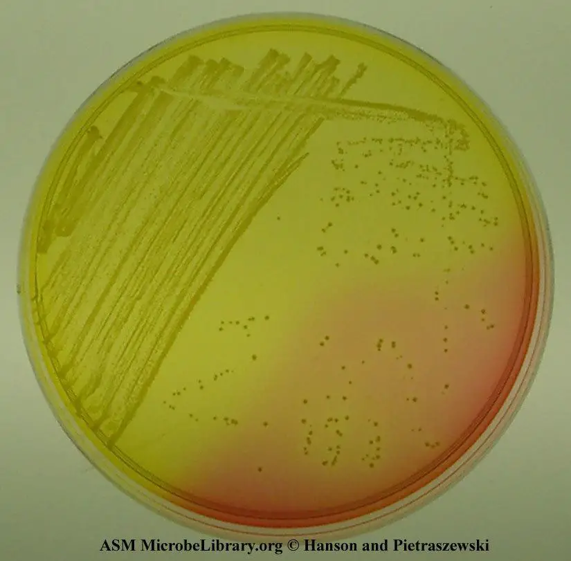Mannitol Salt Agar: Principle, Uses, and Results
