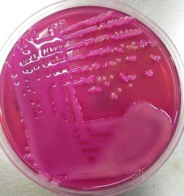 Mucoid colonies of bacteria in MacConkey Agar