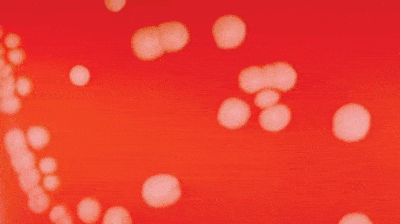 Neisseria meningitidis in Blood Agar Plate
