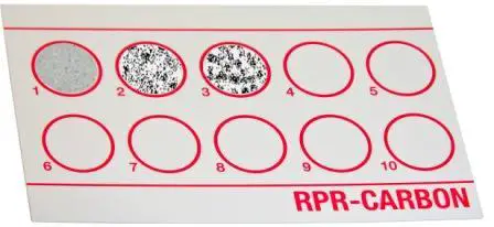 RPR Test: Principle, Procedure, Interpretations