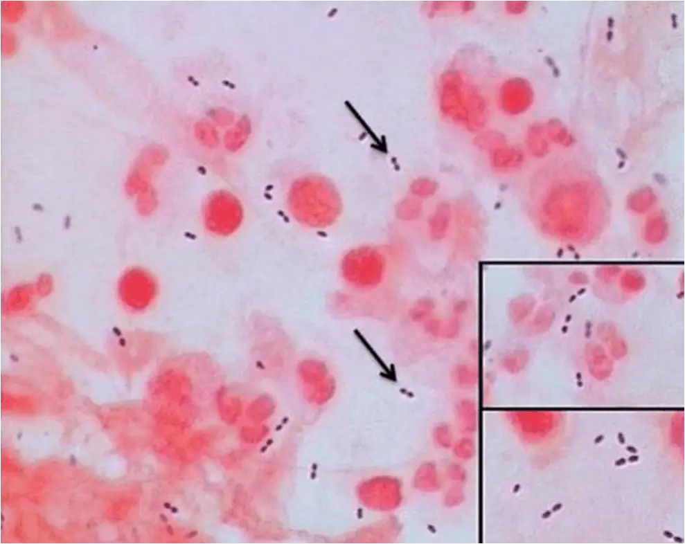 Streptococcus pneumoniae in Gram Stain