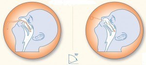 Procedure for Nasopharyngeal aspirate and Swab