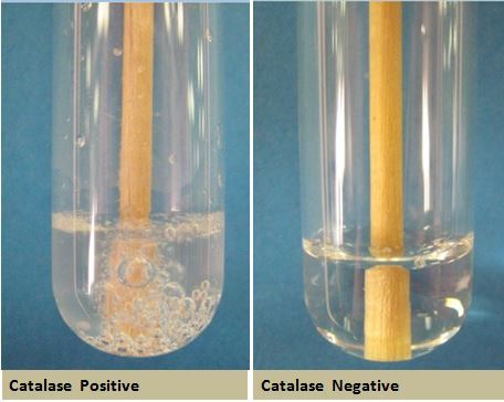 Catalase test: principle, uses, procedure and results