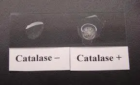 Catalase test: Principle, Procedure, Results, Uses