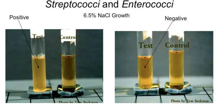 Salt Tolerance Test for Enterococcus species